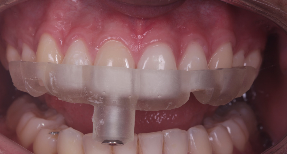 Planificación digital